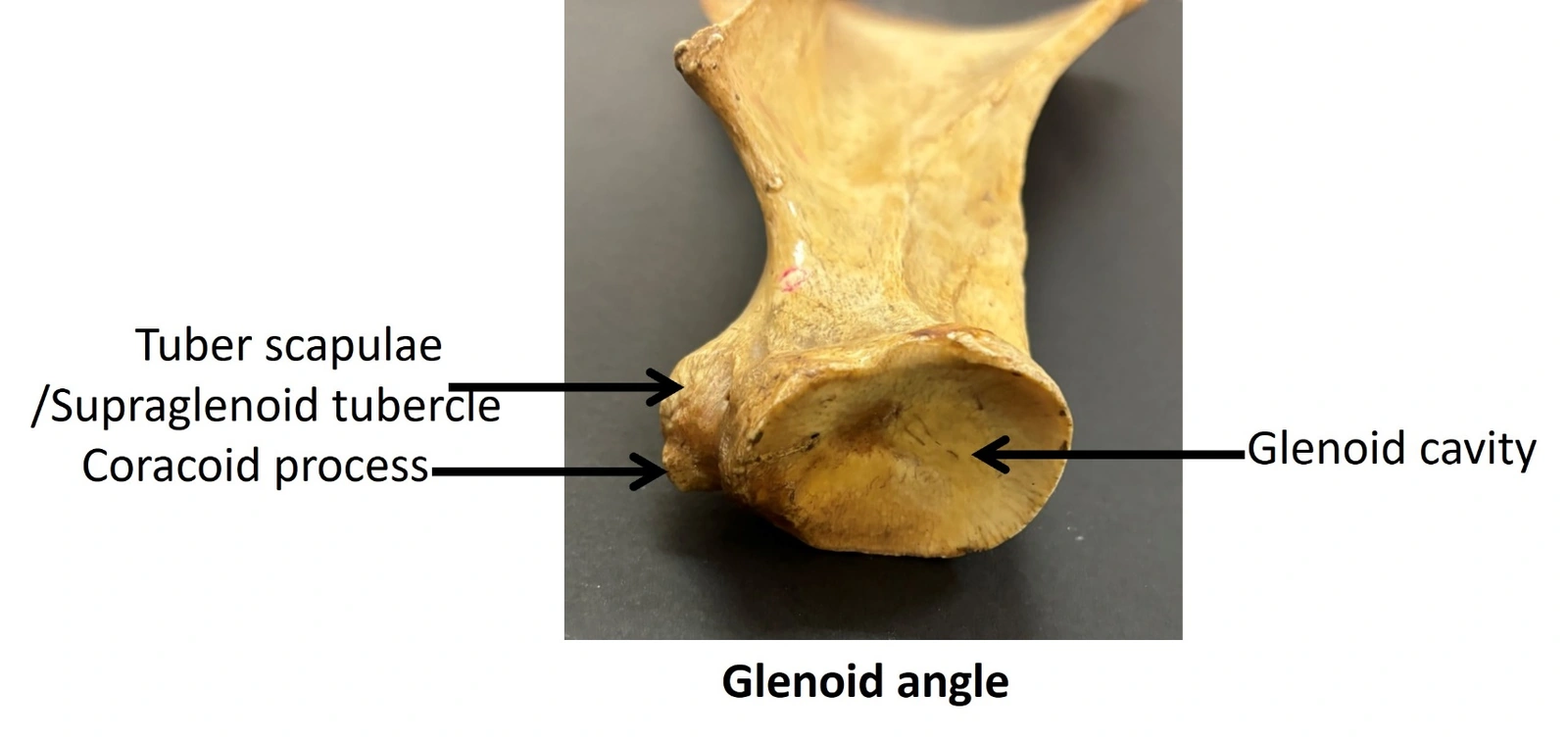 Scapula of Ox — Glenoid angle (distal extremity)